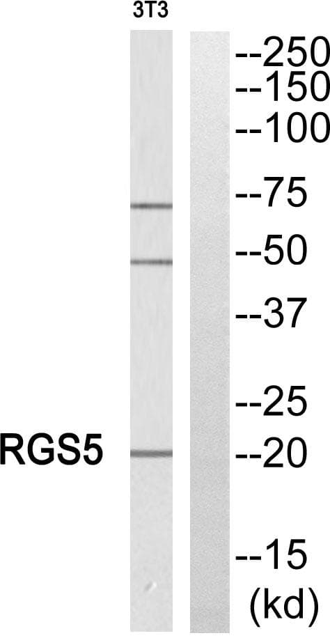 Polyclonal Rabbit anti-Human RGS5 Antibody (IHC, WB)