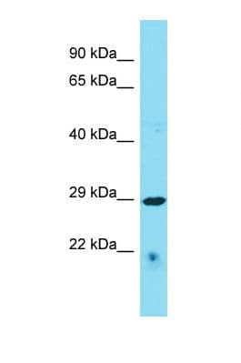 C4orf47 Antibody (aa203-252)