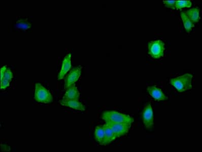 LDHA / LDH1 Antibody