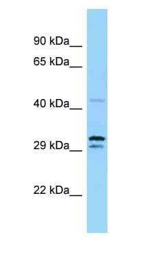 UBE1DC1 / UBA5 Antibody (aa99-148)