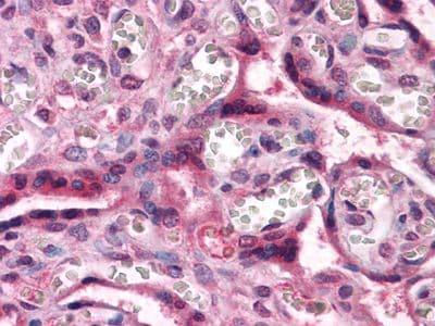 CTNNB1 / Beta Catenin Antibody (clone 4D5)