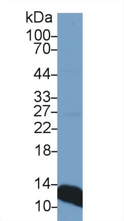 B2M / Beta 2 Microglobulin Antibody (aa21-119, APC)