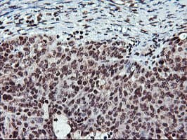 TPSG1 / Tryptase Gamma 1 Antibody (aa20-283, clone OTI1G1)