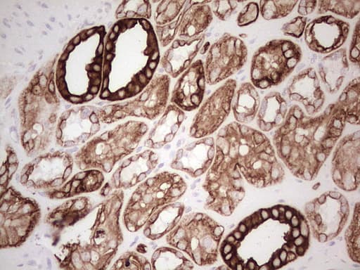 ABCB1 / MDR1 / P Glycoprotein Antibody (aa995-1280, clone OTI11D2, Carrier-free)