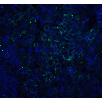 APP / Beta Amyloid Precursor Antibody