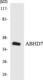 Polyclonal Rabbit anti-Human EPHX4 / Epoxide Hydrolase 4 Antibody (aa91-140, WB)