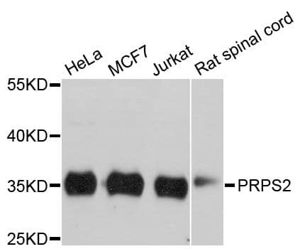 PRPS2 Antibody