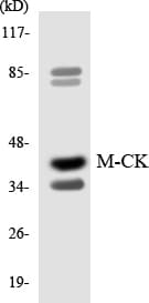 CKM / Creatine Kinase MM Antibody (aa14-63)