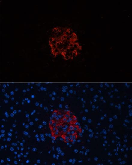 Insulin Antibody