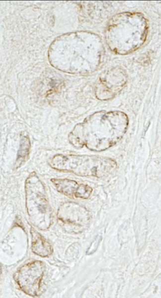 Polyclonal Rabbit anti-Human TOR1AIP1 / LAP1 Antibody (aa275-325, IHC)