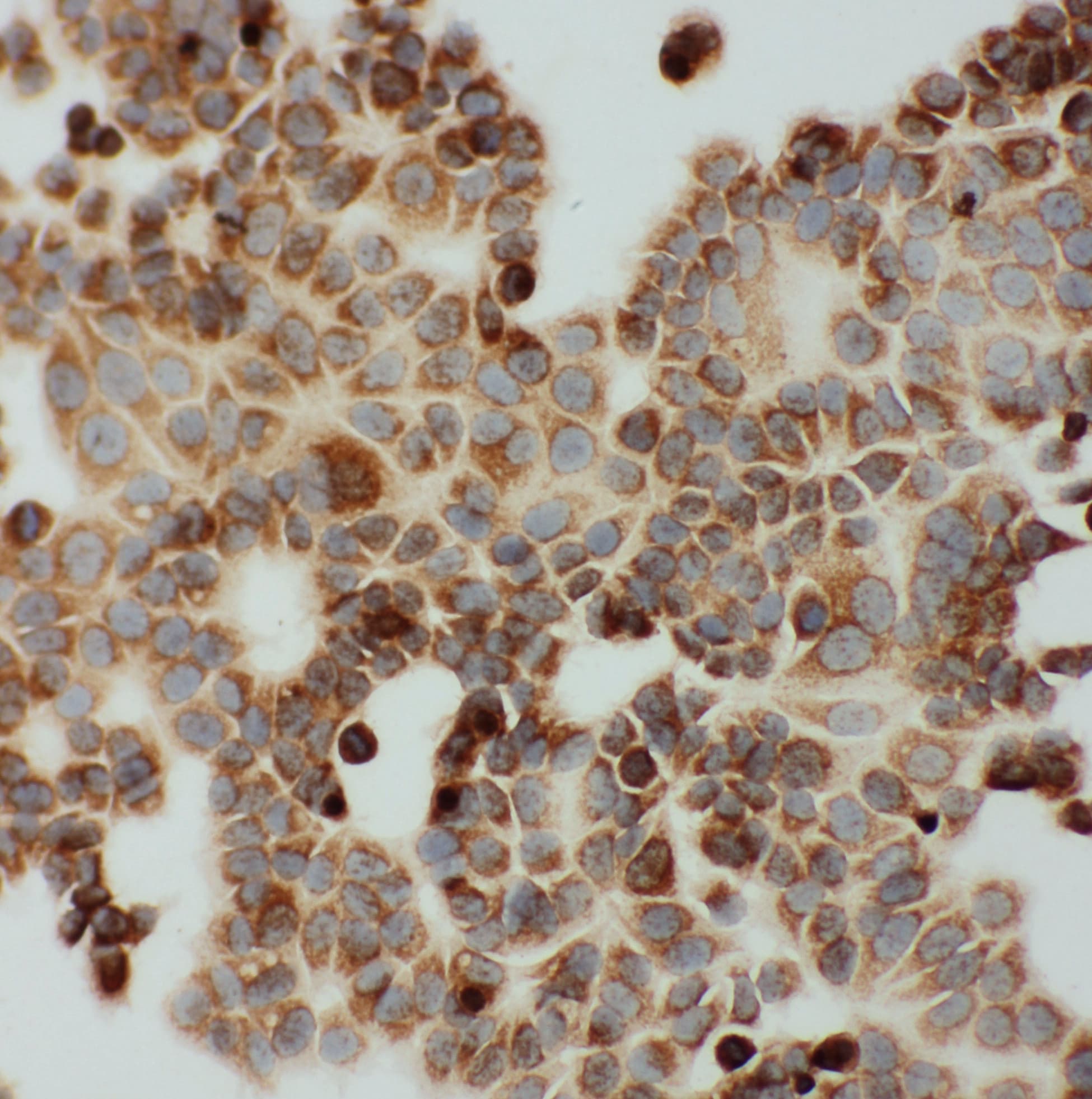 DLD / Diaphorase / E3 Antibody (aa492-509)