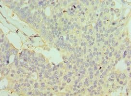 GSTO2 Antibody (aa124-243)