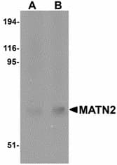 MATN2 / Matrilin 2 Antibody