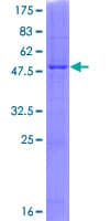 Human PRNP / PrP / Prion Protein (Recombinant GST)