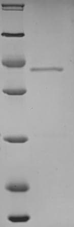 Human SLC8A1 / NCX1 Protein (Recombinant 6His, N-terminus)