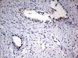 FEN1 Antibody (aa117-380, clone OTI1F3)