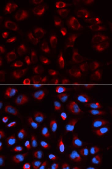 DLD / Diaphorase / E3 Antibody