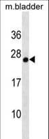 GSTA3 Antibody (aa183-211)