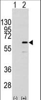 ELK1 Antibody (Ser383)