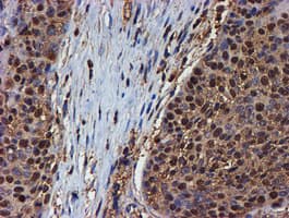 PSMB9 Antibody (aa21-219, clone OTI2G6)
