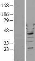 Human WARS Protein (Over-Expression Lysate Myc-DDK (Flag))