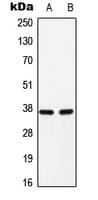 Polyclonal Rabbit anti-Mouse C/EBP Alpha / CEBPA Antibody (phospho-Ser193, WB)