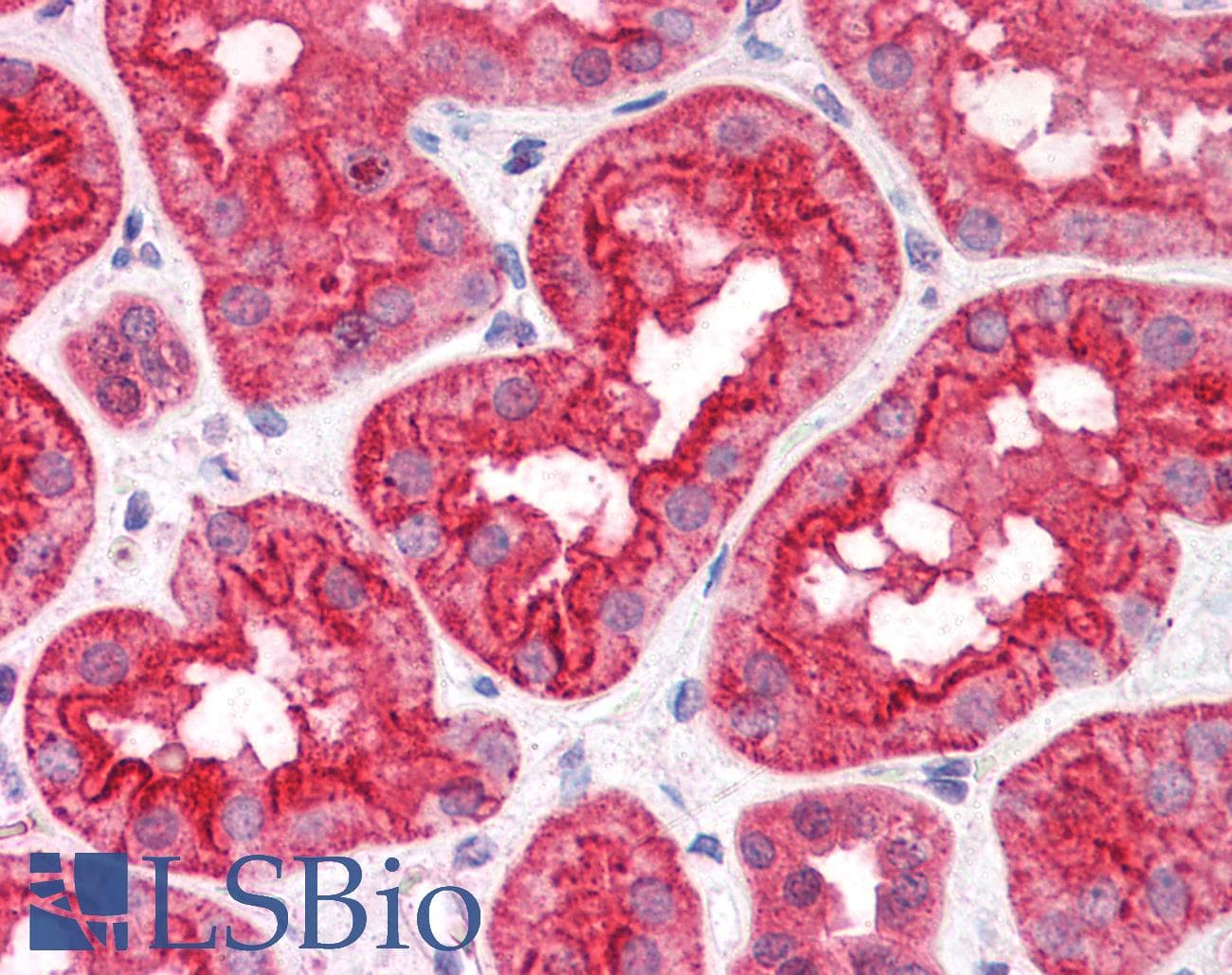 IHC-plus™ ABHD5 Antibody (aa181-192)