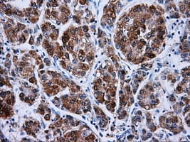 HSD17B10 / HADH2 Antibody (clone OTI5E2)