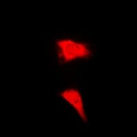 Polyclonal Rabbit anti-Human CTCFL / BORIS Antibody (IF, WB)