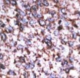 BACE2 Antibody (aa310-339)
