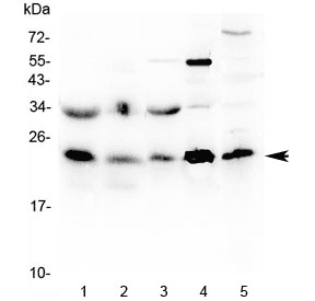 Polyclonal Rabbit anti-Human HSPB8 / H11 / HSP22 Antibody (IHC, WB)