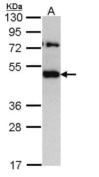 IHC-plus™ TRAM1 Antibody (aa310-374)