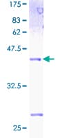 Human ID2 Protein (Recombinant GST)