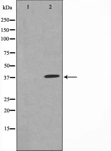 NFKBIA / IKB Alpha / IKBA Antibody