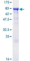 Human FEM1B Protein (Recombinant GST)