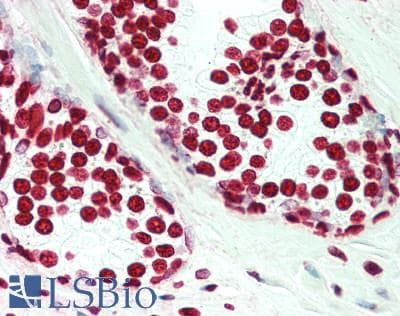 IHC-plus™ HIST1H3H Antibody