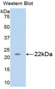GAD65 Antibody (aa1-150, PE)
