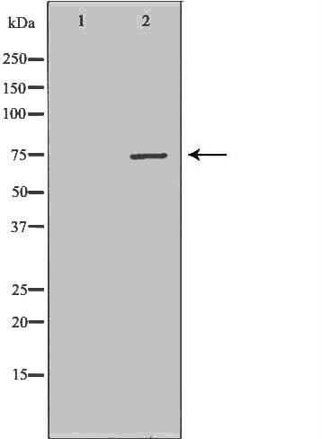 Polyclonal Rabbit anti-Human CPT2 Antibody (IHC, IF, WB)