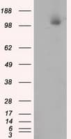 IHC-plus™ Monoclonal Mouse anti-Human ACLY / ATP Citrate Lyase Antibody (clone 3G8, IHC, IF, WB)