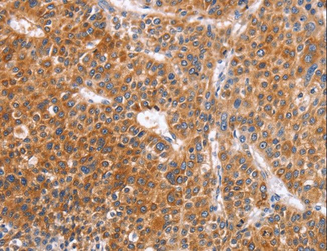 Polyclonal Rabbit anti-Human ABO Glycosyltransferase Antibody (IHC)