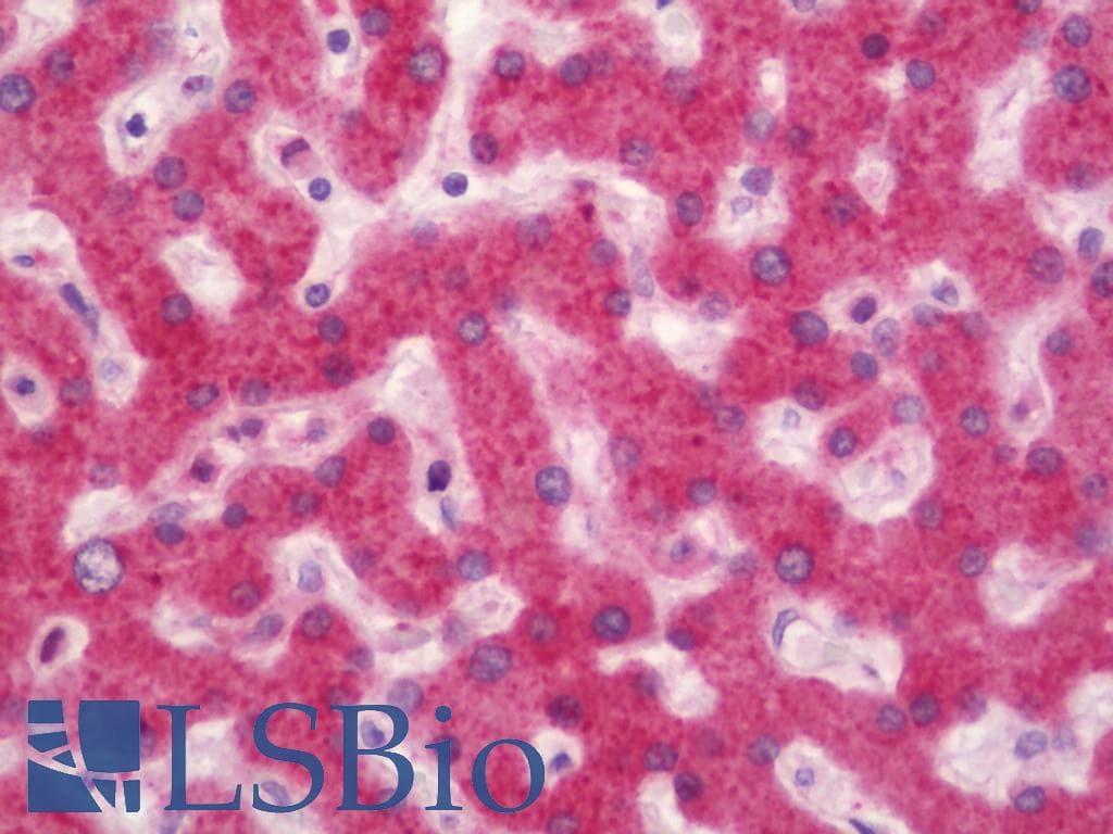 IHC-plus™ MNK / ATP7A Antibody (aa591-640)