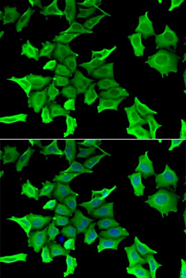Polyclonal Rabbit anti-Human SPINT2 / HAI-2 Antibody (IHC, IF, WB)