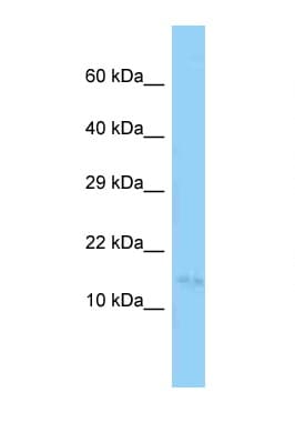 Polyclonal Rabbit anti-Mouse DAT1 / LMO3 Antibody (aa10-59, WB)