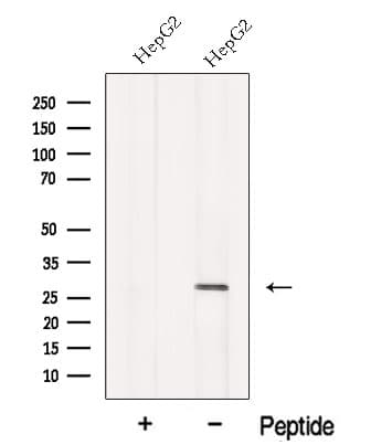 MMAB Antibody