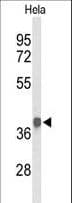PDHA1 / PDH E1 Alpha Antibody (aa226-255)