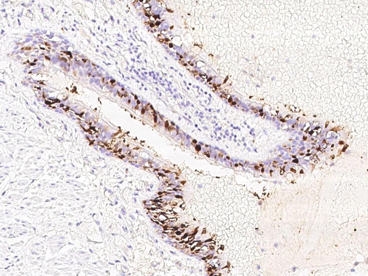 SERPINB3 Antibody