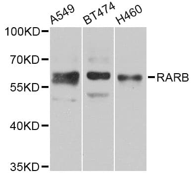 RARB / RAR Beta Antibody