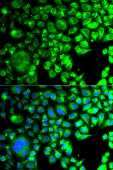 TBPL1 / TRF2 Antibody