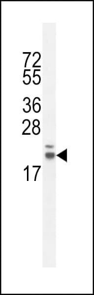 Polyclonal Rabbit anti-Human RNF185 Antibody (aa88-117, WB)