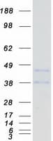 Human CD72 Protein (Recombinant Myc-DDK (Flag))